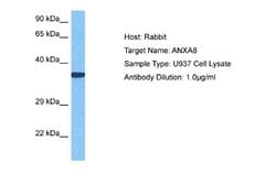 Annexin A8 like2 Rabbit anti-Human, Polyclonal, Novus Biologicals 0.1 mL | Buy Online | Novus Biologicals | Fisher Scientific